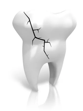 Dental Loupes make it easier to find tooth cracks.